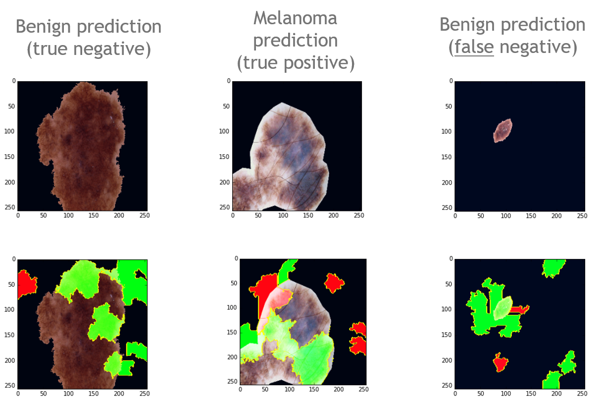 melanoma and lime